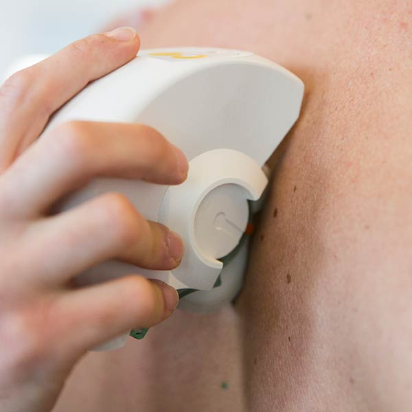 Rücken-Scan – Horizonte Gesundheitsstudio